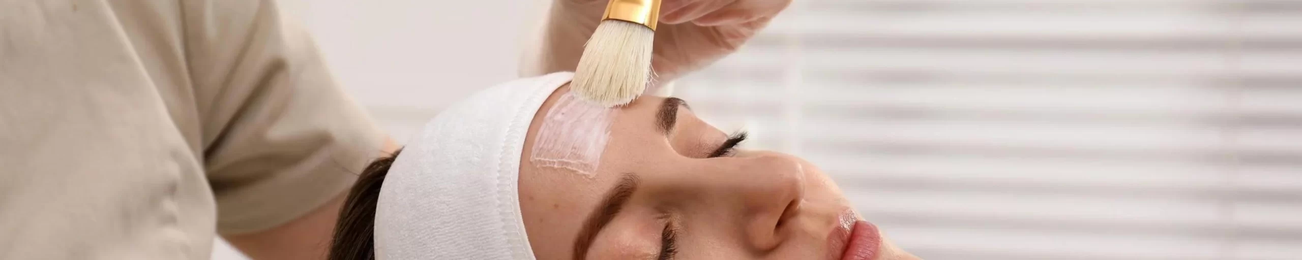 kimyasal peeling