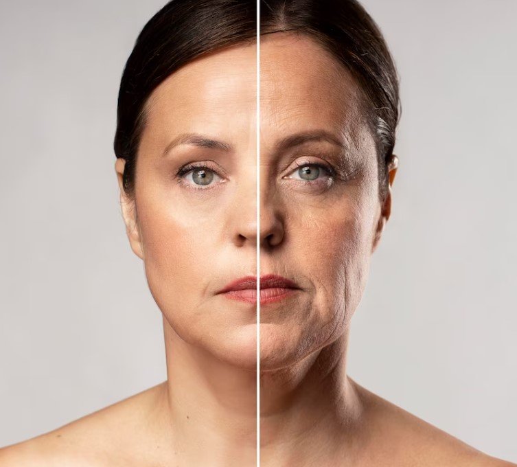 Mezoterapi Ne Kadar Sürede Etki Eder